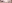二重まぶた（自然癒着法） — ルホ美容外科クリニック