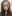 Full-face fat grafting (autologous fat transfer) — TOP Plastic Surgery