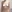 豊胸術（シリコンインプラント／人工乳腺） — バナナ美容外科クリニック