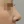 ผ่าตัดแก้ไขภาวะลิ้นจมูกตีบ/ยุบ (Nasal valve stenosis) — หลังทำ (30วัน) · Jindam Plastic Surgery Clinic