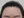 ปลูกผมบริเวณจอน — หลังทำ (365วัน) · ยงด๊อกเตอร์คลินิก