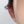 耳垂整形（丰耳垂/耳垂修复） — 术后 (30天) · 麒麟医美诊所
