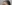 生え際の植毛（ヘアライン植毛） — 清潭OKクリニック