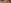 二重まぶた（自然癒着法） — プロミス美容外科クリニック