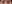 眼瞼下垂手術（目つき矯正） — ハイボム美容外科クリニック