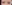 埋没法（二重埋没法） — クッキー美容外科クリニック