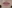 Lip filler (lip augmentation with HA) — Private Beauty Clinic Jiyu