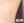 กำจัดขนรักแร้ด้วยเลเซอร์ — หลังทำ (300วัน) · โอริเฟซ ซองโด คลินิกฮอไรซัน