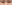 二重まぶた（自然癒着法） — フルルン美容外科クリニック