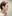 鼻尖形成術（自家軟骨移植） — ルホ美容外科クリニック