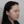 Density Lifting (RF skin tightening / lifting) — after · Ripain Clinic