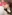 団子鼻修正（鼻尖縮小術） — コード美容外科クリニック