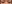 涙袋形成（脂肪注入） — ファクト美容外科クリニック