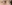 二重まぶた（自然癒着法） — プロミス美容外科クリニック