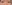 裏ハムラ法（経結膜的眼窩脂肪移動術） — プレジャー美容外科クリニック