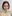 ミニリフト（小切開フェイスリフト） — チャ・ミン美容外科クリニック
