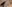 二重まぶた（自然癒着法） — ゼロワン美容外科クリニック