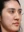 Thread embedding acupuncture lift (Korean-medicine 'maeseon' acupoint thread lift) — before · Garoseo Oriental Clinic - Gangnam Branch