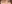 唇のヒアルロン酸注入（リップヒアルロン酸） — ドレス美容外科クリニック