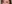 二重まぶた（自然癒着法） — プロミス美容外科クリニック