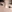 Natural adhesion double eyelid surgery (non-incisional adhesion method) — Yellow Plastic Surgery Clinic