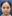 Double chin liposuction (submental liposuction) — Jewelry Plastic Surgery Clinic