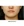 Volnewmer (โวลนิวเมอร์ ยกกระชับด้วย RF) — ก่อนทำ (30วัน) · คลินิกศัลยกรรมตกแต่งนาบี