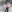 肋軟骨移植による鼻形成 — D-day美容外科クリニック