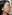Platysma plication (corset platysmaplasty for double chin/jawline) — Shinsang Plastic Surgery Clinic