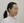 全脸提升（全面部提升） — 术后 · 罗芭尔诊所