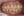 MTA orthodontics (Mini-Tube Appliance partial braces) — before (177days) · Lucent Dental Clinic