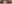 Lateral canthoplasty (outer corner opening) — Jewelry Plastic Surgery Clinic