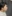 二重あごの脂肪吸引（顎下脂肪吸引） — ディユ美容外科クリニック