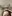 額縮小術（生え際下げ・ヘアライン下降術） — ザフィックス美容外科クリニック
