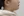 ตัดไขมันกระพุ้งแก้ม — ก่อนทำ (8วัน) · คลินิกศัลยกรรมพลาสติกรีไวนด์