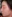 revision rhinoplasty — Coco Line Clinic