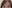 Natural adhesion double eyelid surgery (non-incisional adhesion method) — I-Fit Plastic Surgery Clinic