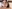 Revision facial contouring surgery (secondary facial bone surgery) — Uri Plastic Surgery Clinic