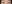 Natural adhesion double eyelid surgery (non-incisional adhesion method) — Thank You Plastic Surgery