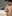 Nasal Tip Plasty with Autologous Cartilage — Nana Plastic Surgery Clinic