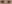 裏ハムラ法（経結膜的眼窩脂肪移動術） — ファクト美容外科クリニック