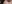 二重まぶた（自然癒着法） — プロミス美容外科クリニック