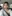 Nasal Tip Plasty with Autologous Cartilage — Uri Plastic Surgery Clinic