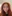 revision eyelid surgery (secondary blepharoplasty) — DA Plastic Surgery Clinic