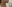 Double chin liposuction (submental liposuction) — Uri Plastic Surgery Clinic