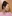 鼻尖形成術（自家軟骨移植） — D-day美容外科クリニック