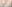 豊胸（脂肪注入） — ソウルアイ美容外科クリニック