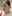 Rejuran Healer (salmon-DNA polynucleotide / PN skin booster) — Cha Min Plastic Surgery Clinic