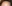 額縮小術（生え際下げ・ヘアライン下降術） — ザフィックス美容外科クリニック