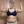 Brachioplasty (arm lift) — before (30days) · The Line Plastic Surgery